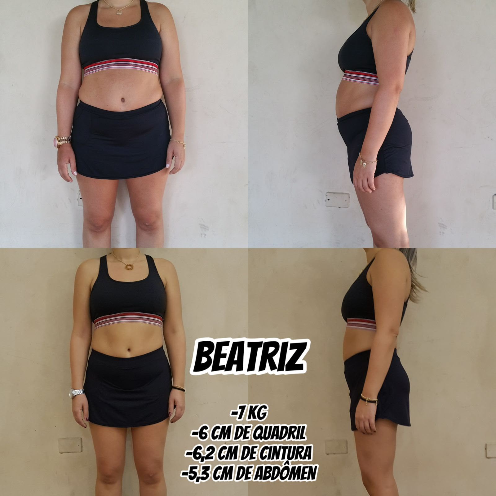 Antes e depois — Beatriz
