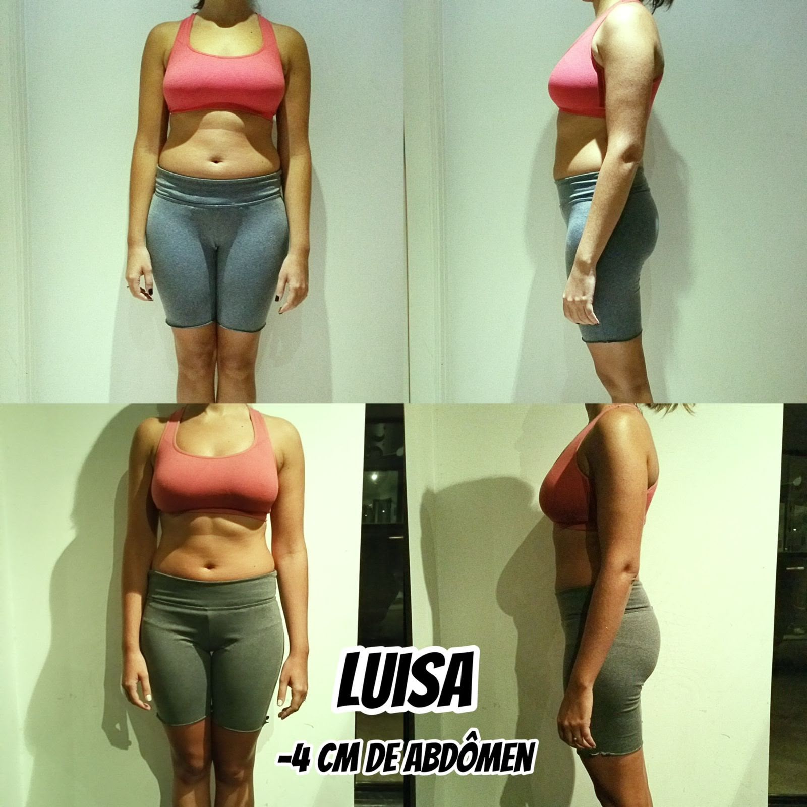 Antes e depois — Luisa