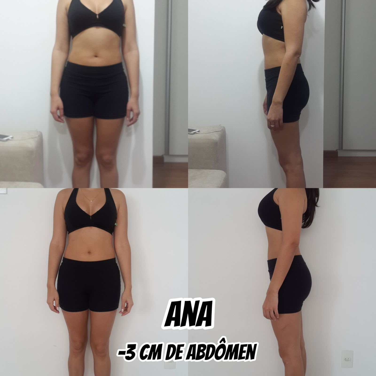 Antes e depois — Ana